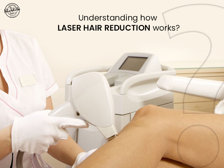laser hair reduction