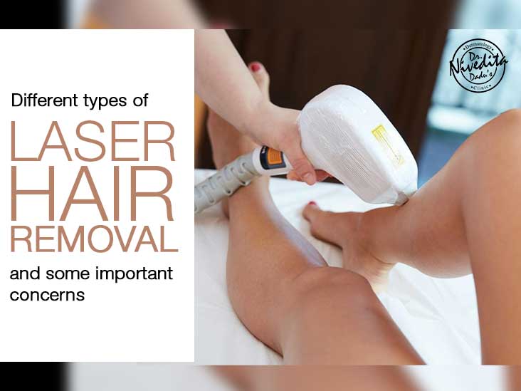 Laser Hair Removal