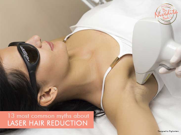Myths about Laser Hair Reduction